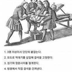 중세 요료결석 수술